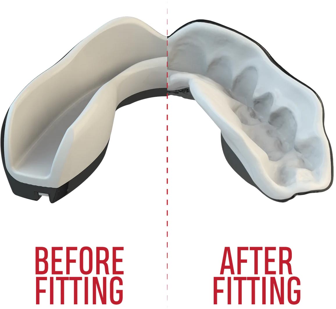 SAFEJAWZ Mouth guard “Extro Fangz” junior at Bytomic Trade and Wholesale